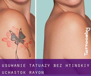 Usuwanie tatuaży bez htinskiy Uchastok Rayon