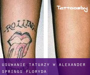 Usuwanie tatuaży w Alexander Springs (Floryda)
