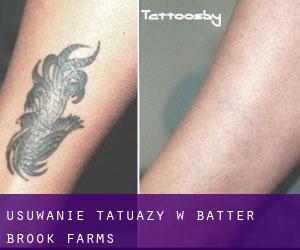 Usuwanie tatuaży w Batter Brook Farms