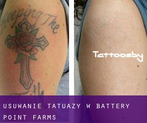 Usuwanie tatuaży w Battery Point Farms