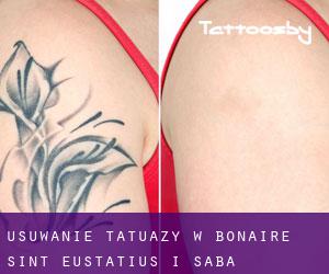 Usuwanie tatuaży w Bonaire, Sint Eustatius i Saba