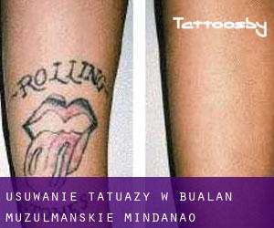 Usuwanie tatuaży w Bualan (Muzułmańskie Mindanao)