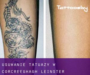 Usuwanie tatuaży w Corcreeghagh (Leinster)