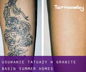 Usuwanie tatuaży w Granite Basin Summer Homes