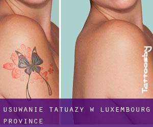 Usuwanie tatuaży w Luxembourg Province