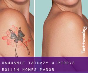 Usuwanie tatuaży w Perrys Rollin' Homes Manor