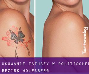 Usuwanie tatuaży w Politischer Bezirk Wolfsberg