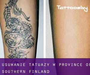 Usuwanie tatuaży w Province of Southern Finland