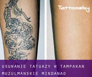 Usuwanie tatuaży w Tampakan (Muzułmańskie Mindanao)