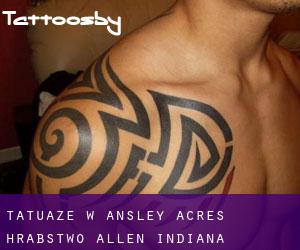 tatuaże w Ansley Acres (Hrabstwo Allen, Indiana)