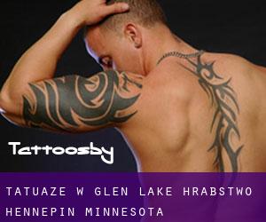 tatuaże w Glen Lake (Hrabstwo Hennepin, Minnesota)